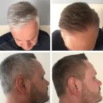 Ősz haj elleni tonik -GR-7 Professional